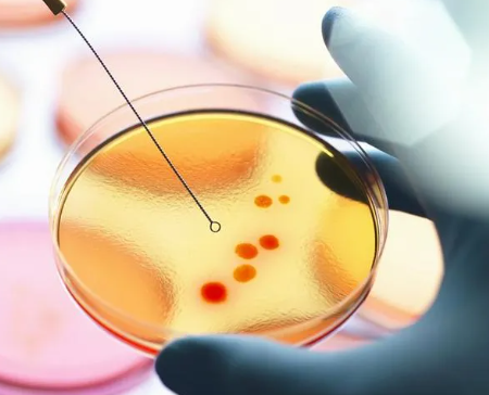 Ecuador en alerta: ocho niños mueren por brote de leptospirosis; Ordene UpBocas –