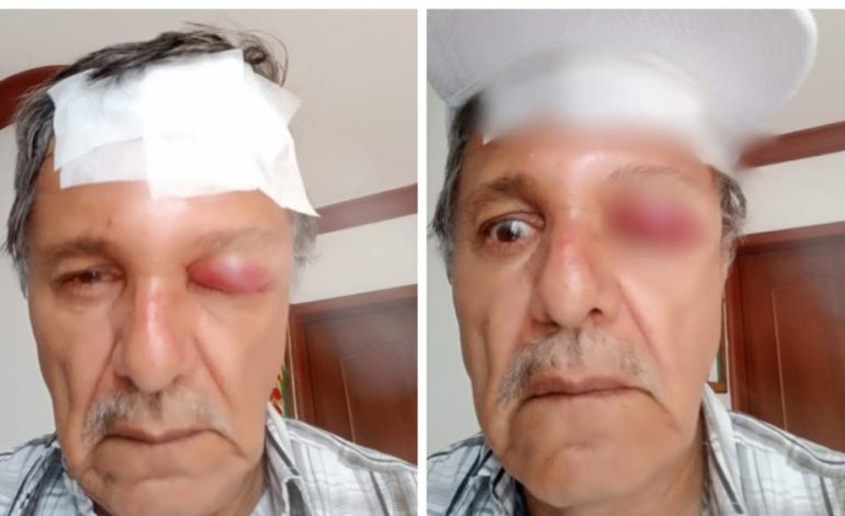  Así es como el caso del camarógrafo atacó en Cali

 – En un click