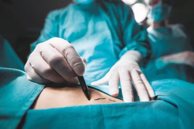  En 2024, el 30 % de los pacientes con cirugía estética de Colombia eran extranjeros

 – En un click