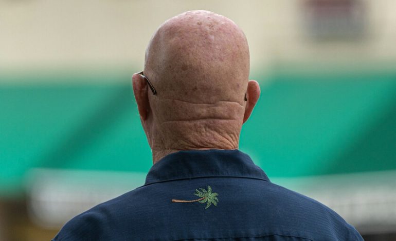  Minoxidil parecía el gran medicamento milagroso contra la calvicie. Una compañía farmacéutica financiada por Google acaba de superarlo

 – En un click