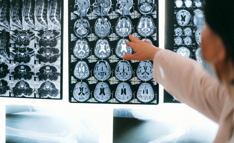  Los golpes se han convertido en un gran problema de salud silencioso en España. Y hay formas de limitar los riesgos

 – En un click