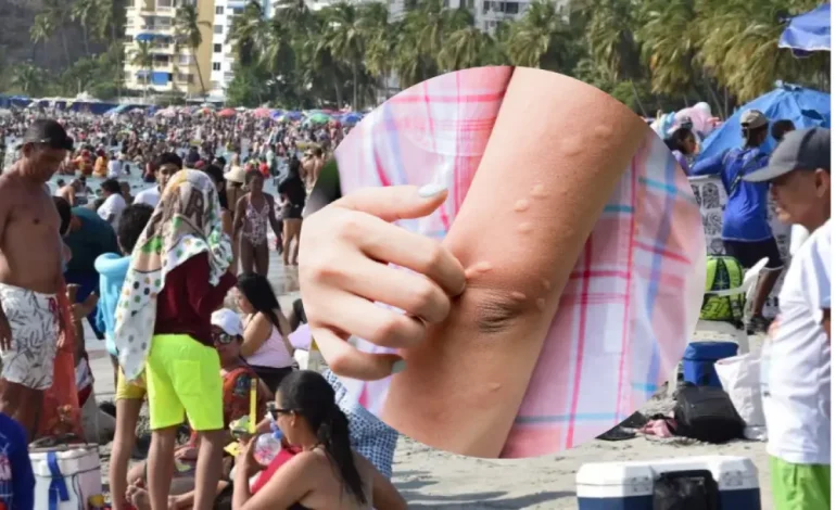  Bathers informa brotes en la piel después de ingresar al mar en Santa Marta; La mujer afectada le dice su experiencia

 – En un click
