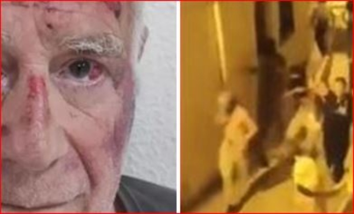  El hombre atacó en Torre Pacheco «Solo me golpearon»

 – En un click