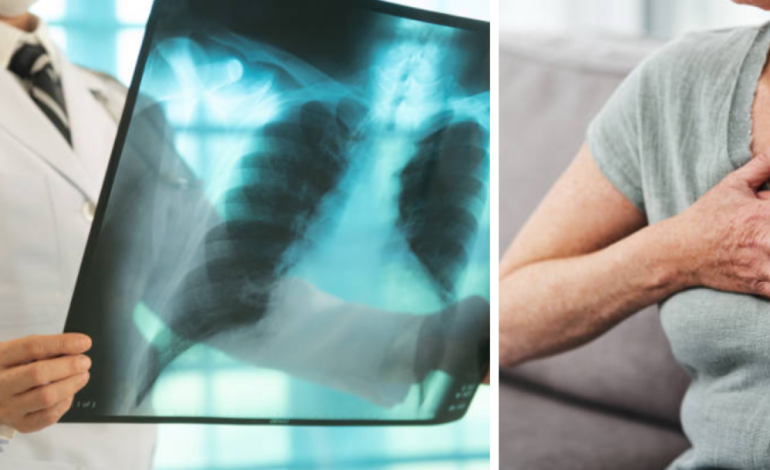  El DADIS informa más de 300 casos de tuberculosis hasta 2025

 – En un click