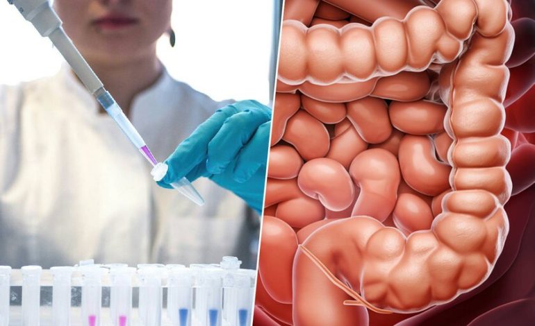 Los cánceres de colon están aumentando de forma alarmante entre los jóvenes. Tenemos un sospechoso: el sedentarismo

 – En un click