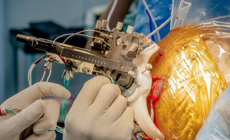 Innovador experimento médico en América Latina: implantan chips simultáneamente en el cerebro para mejorar síntomas del Parkinson

 – En un click