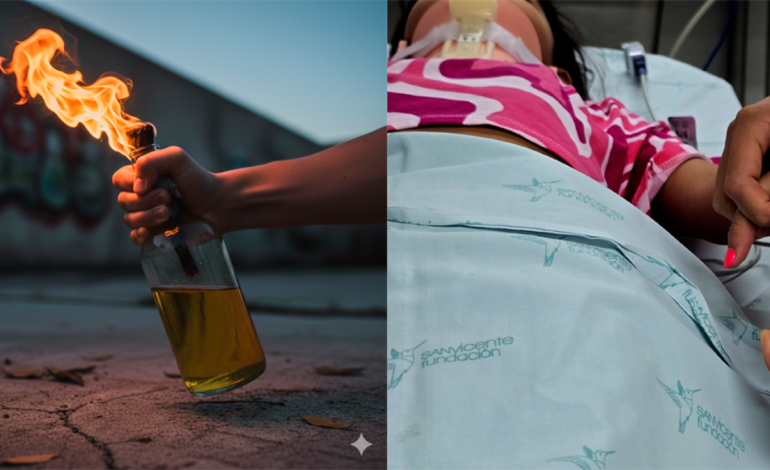  Niño de 4 años murió tras ser hospitalizado por graves quemaduras cuando le arrojaron una botella de gasolina encendida

 – En un click