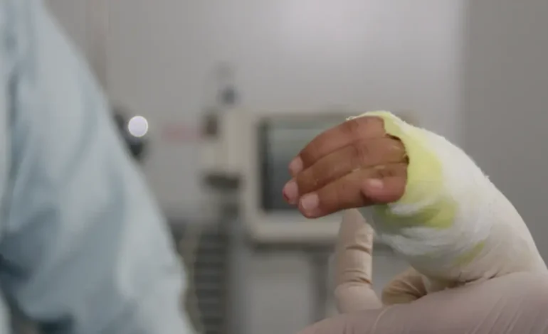  Un menor de ocho años se encuentra en la UCI debido a graves quemaduras por gasolina que recibió en su cuerpo.

 – En un click